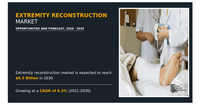 Extremity Reconstruction Market 2022 providing a clear understanding of the Extremity Reconstruction Market 2022 providing a clear understanding of the present position of the market players