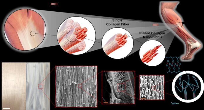 Artificial Tendons and Ligaments Market Expected to Expand at a Steady 2022-2028