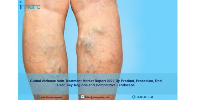 Varicose Vein Treatment Market Size, Industry Share, Analysis, Report and Forecast 2022-27
