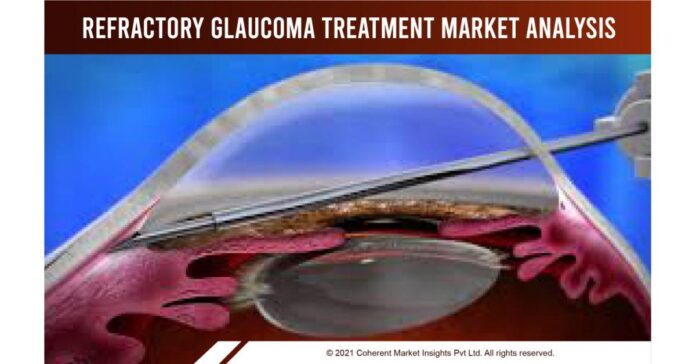 Refractory Glaucoma Treatment Market Growth in Future Scope 2022-2028