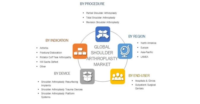 Shoulder Arthroplasty Market | Analysis by Growth, Size, Application, Demands and Business Outlook