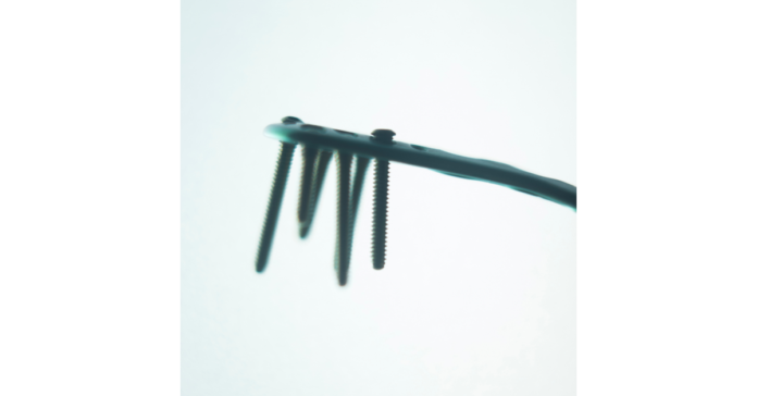 Declining Prices Limit Global Orthopedic Trauma Device Market