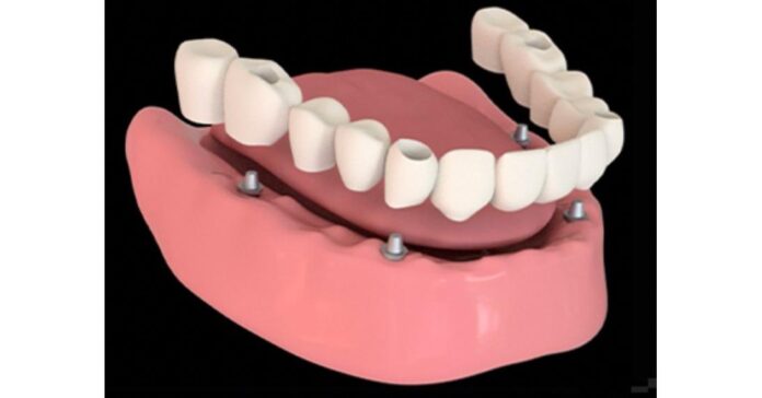 TruBridge Is a Fairy Tale Story Come True for Thousands of Dental Patients