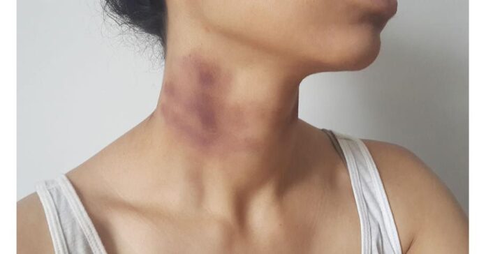 A New Holiday is Celebrated on February 19th Now: National Hickey Day