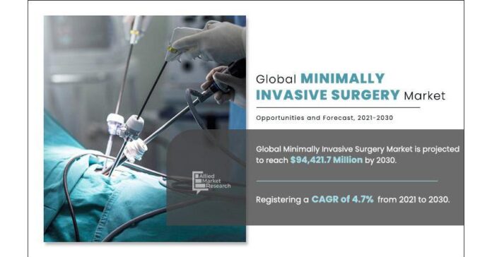 Minimally Invasive Surgery Market Is Projected to Reach $94.421 Billion Minimally Invasive Surgery Market Is Projected to Reach $94.421 Billion by 2030