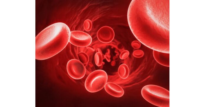 Sickle Cell Disease Treatment Market is estimated to be US$ 9.22 billion by 2030 with a CAGR of 15.6%-By PMI