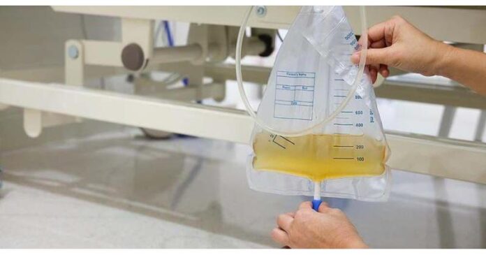 Urine Flow Meters Market is estimated to be US$ 60.0 million by 2032