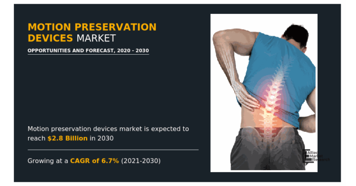 Motion Preservation Devices Market Is Expected to Reach $2.8 Billion by 2030