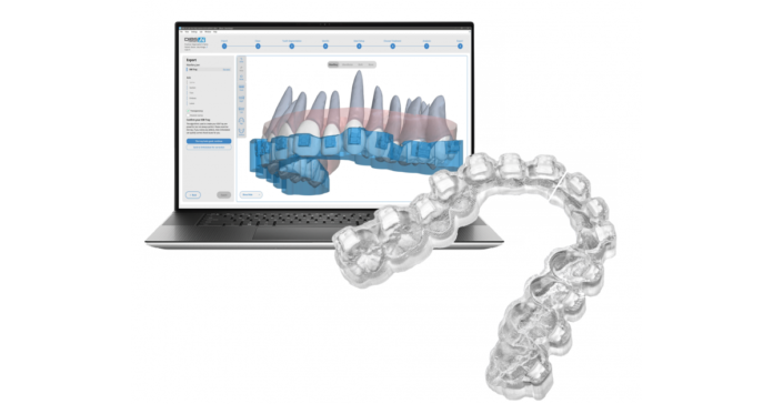Braces On Demand Tailors Orthodontic Treatment to Individual Patients with BLUEPRINT