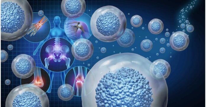 Cancer Pain Therapeutics Market Gaining Momentum with Positive External Factors