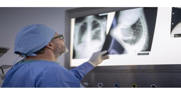 Dynamics of Medical X-Ray Market: Advancements in X-Ray Technology Dynamics of Medical X-Ray Market: Advancements in X-Ray Technology