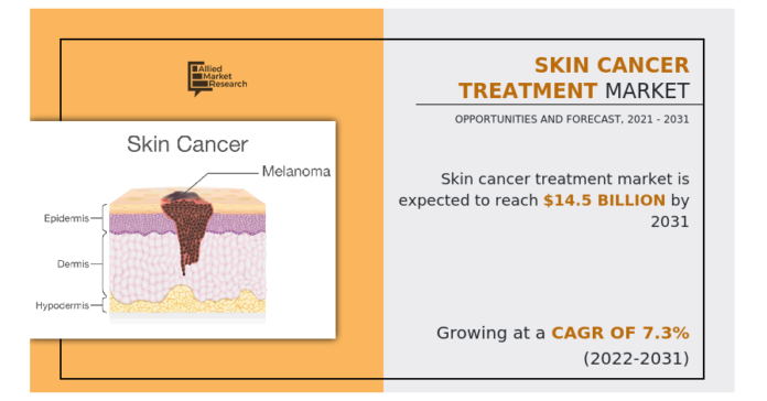 Skin cancer treatment market is projected to exhibit substantial growth rate , to expand at USD 14.5 billion by 2031