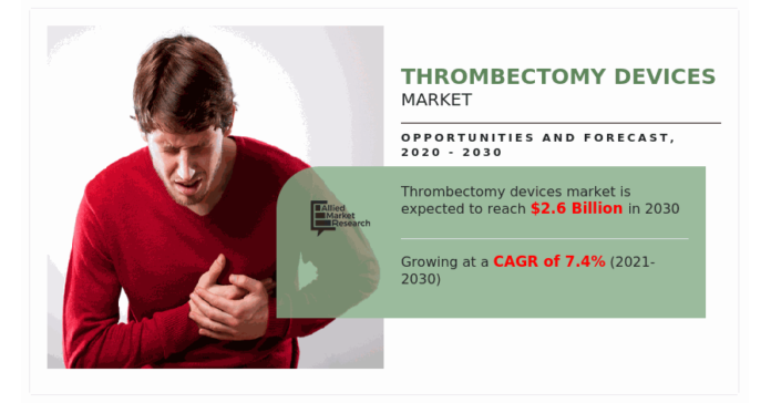 Thrombectomy Devices Market is Anticipated to Surpass USD 2.6 Billion by 2030, Opportunists and Trends 2023