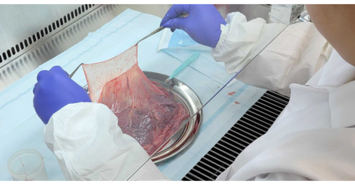 Americord Adds AABB Accreditation for State-of-the-Art Lab