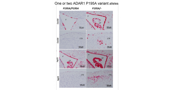Flipons help ADAR1 turn off inflammation