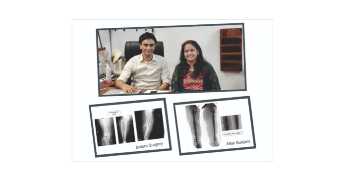 Wheelchair to Walking Again an Inspiring Story of a 57YearOld Mother
