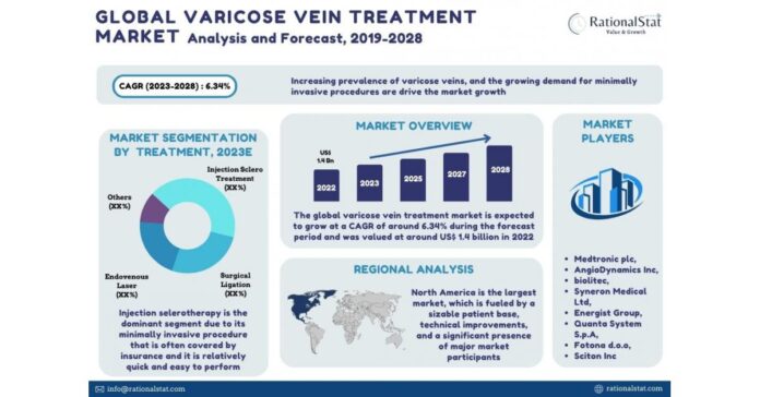 Varicose Vein Treatment Market is expected to reach US$ 2.3 billion by 2030, says Market report published: RationalStat