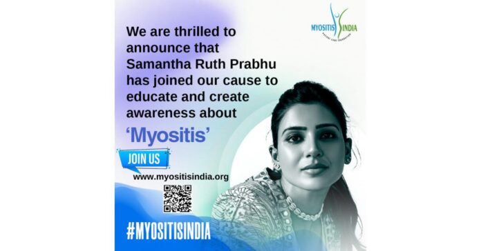 Myositis India Announces Renowned Actress Samantha Ruth Prabhu as Brand Ambassador to Take on Rare Diseases in India