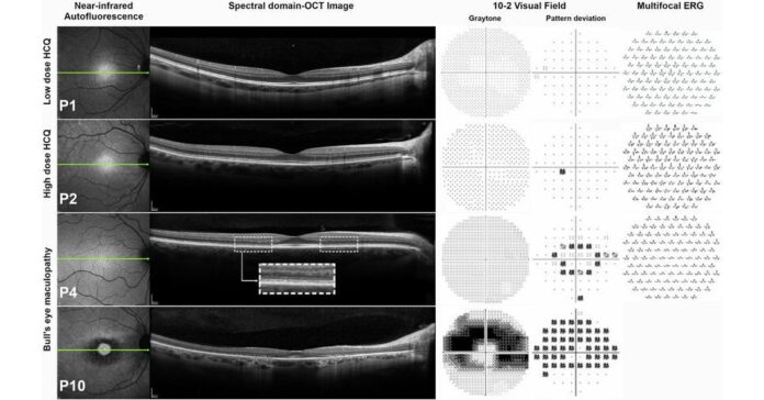 Dr. Amaro-Quireza of Columbia University Medical Center and Bronx Lebanon Hospital Center joins Retina Group of NY