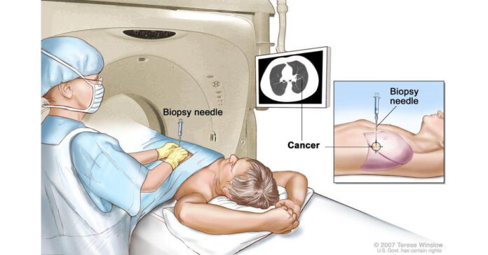 Interventional Radiology Market Booms as Minimally Invasive Procedures Gain Popularity