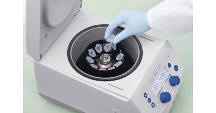 Laboratory Centrifuge Market Benefits from Growing Healthcare Diagnostics Sector