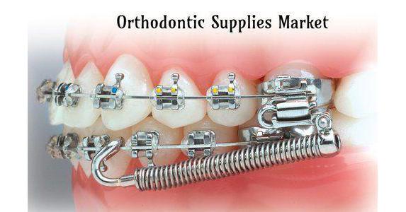orthodontic-supplies-market.jpeg Orthodontic Supplies Market to Witness Major Growth by 2028