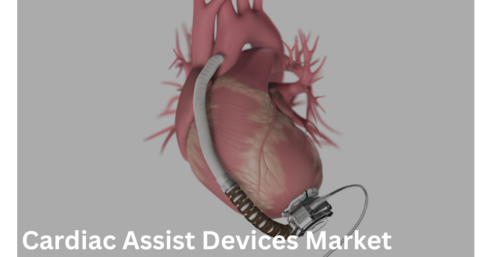Cardiac Assist Devices Market By Supply And Consumption Demand Analysis To 2023