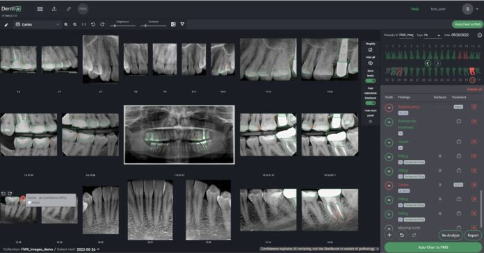 DENTI.AI PIONEERS FDA-CLEARED PATHOLOGY DETECTION IN BOTH PANORAMIC AND INTRAORAL X-RAYS WITH LAUNCH OF DENTI.AI DETECT