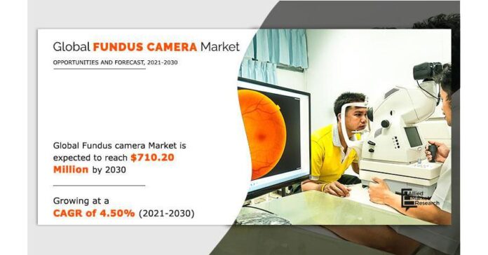 Fundus Camera Market Expected to Reach $710.20 Million by 2030