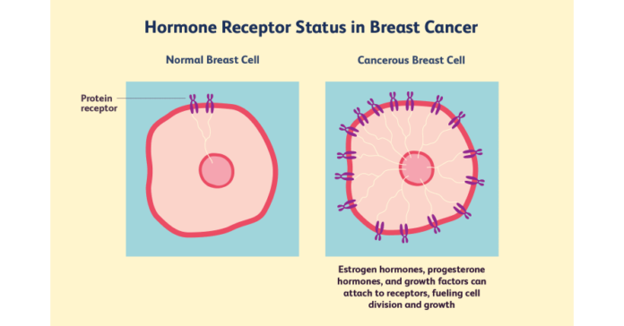 Current Trends in the Hormone Refractory Breast Cancer Market and Industry Forecast, 2023-2032