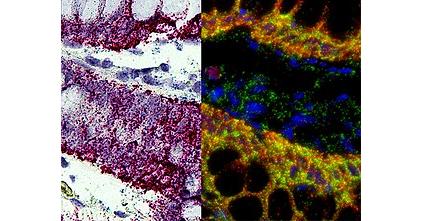 In-Situ Hybridization Market Size | Share | Competitive Landscape In-Situ Hybridization Market Size | Share | Competitive Landscape