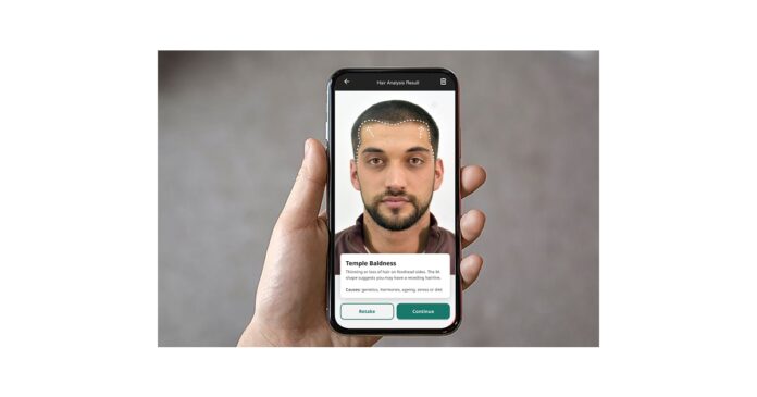 OG_Multimedialog_94326.jpg Cureskin to Launch World’s First AI-Powered Hair Analyser to Combat Baldness on 20th April 2025
